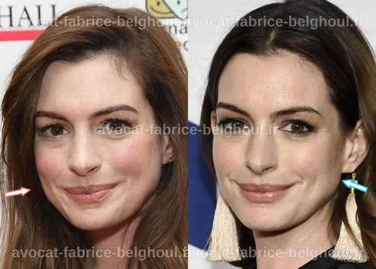 Transformation d'Anne Hathaway, montrant les changements de son visage en 2021.