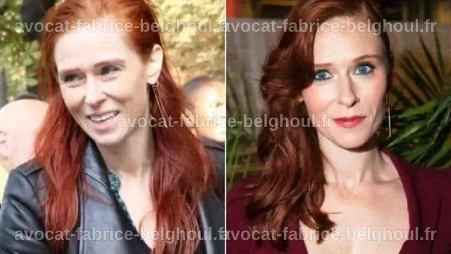 Comparaison avant/après d'Audrey Fleurot suite à une intervention chirurgicale.