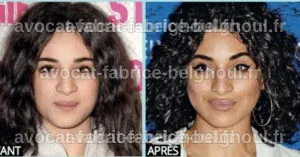 Camélia Jordana discutant des rumeurs sur sa chirurgie esthétique avec un air pensif.