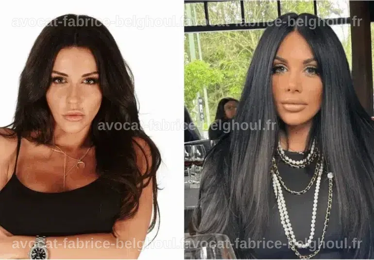 Comparaison avant-après des transformations esthétiques de Laura Lempika.