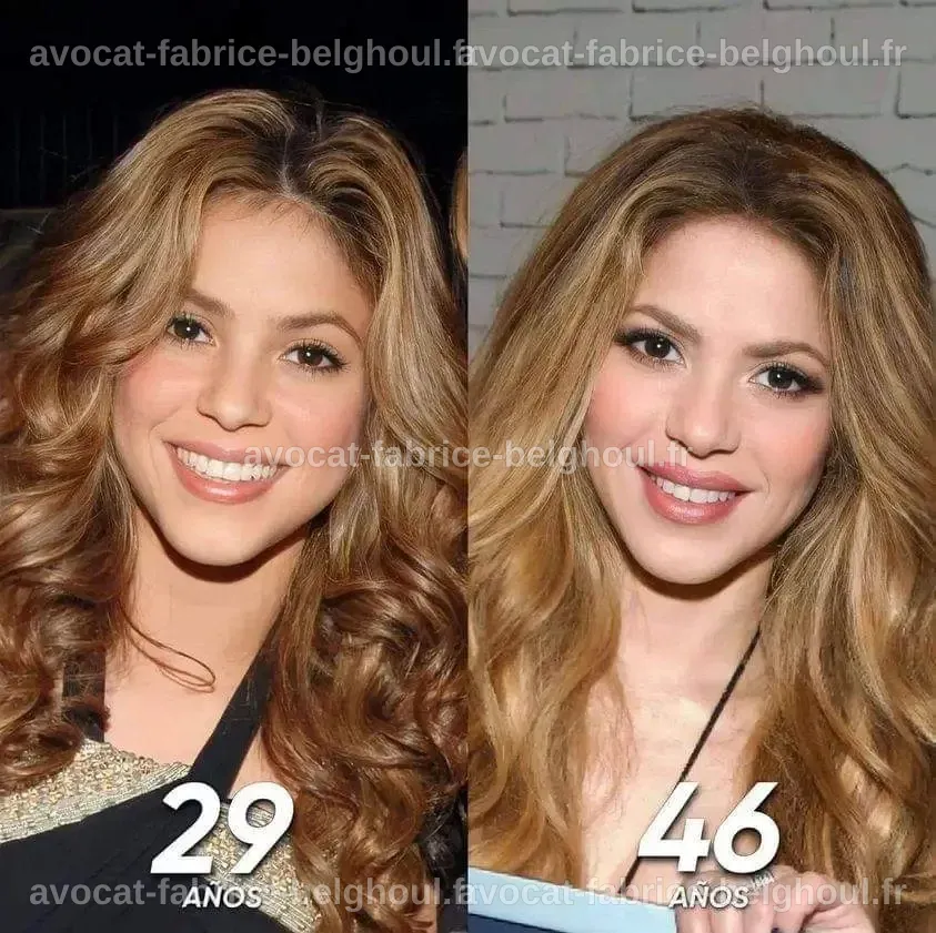 Avant et après de Shakira, illustrant son parcours de chirurgie esthétique.